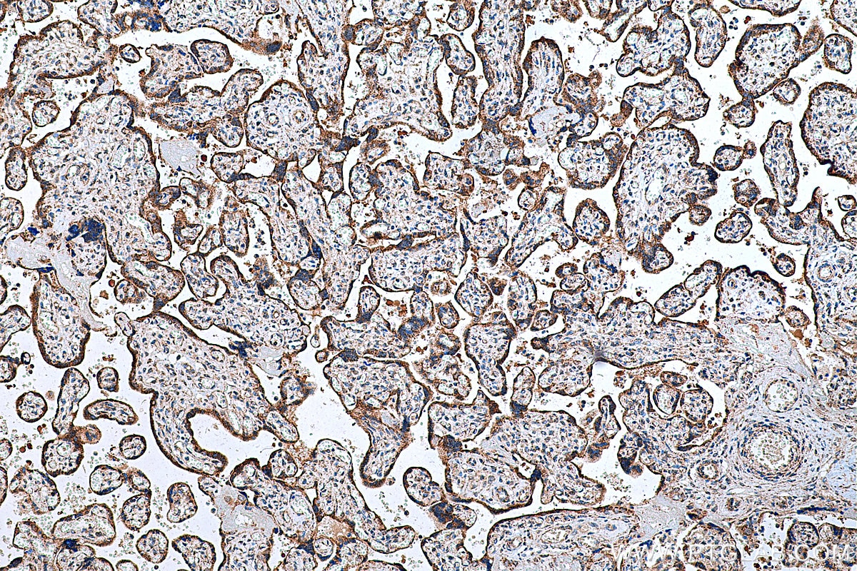 Immunohistochemistry (IHC) staining of human placenta tissue using FH Polyclonal antibody (11375-1-AP)