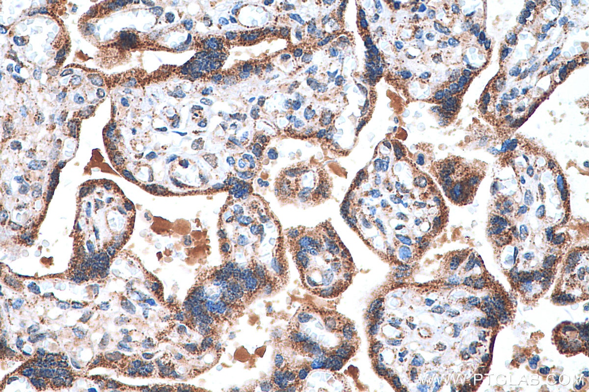 Immunohistochemistry (IHC) staining of human placenta tissue using FH Polyclonal antibody (11375-1-AP)