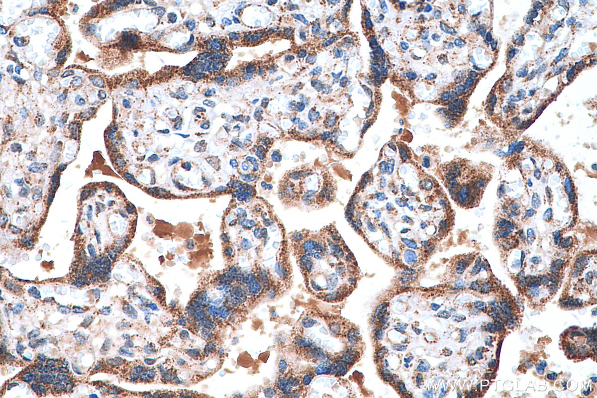 IHC staining of human placenta using 11375-1-AP