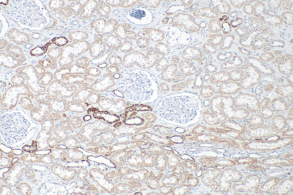 Immunohistochemistry (IHC) staining of human kidney tissue using FH Polyclonal antibody (11375-1-AP)