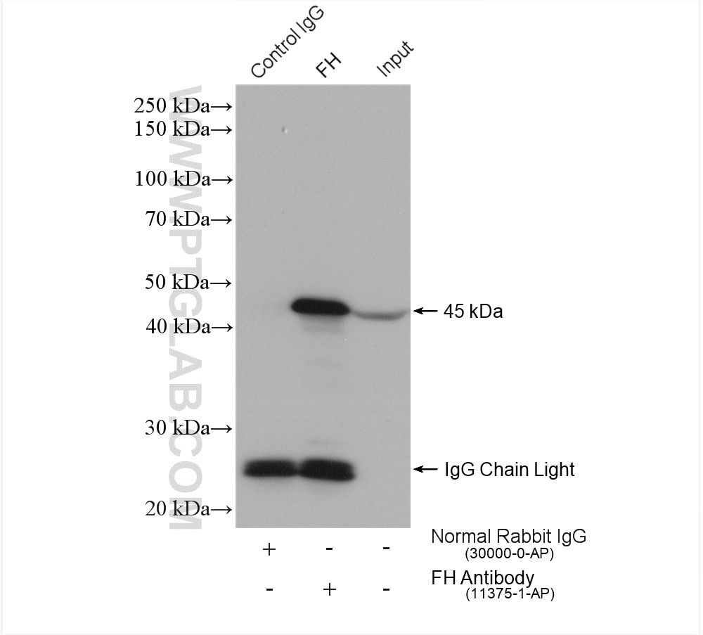 Immunoprecipitation (IP) experiment of mouse liver tissue using FH Polyclonal antibody (11375-1-AP)