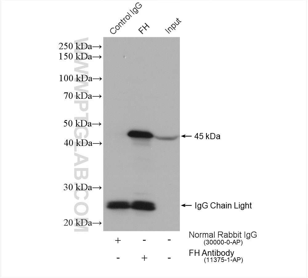 IP experiment of mouse liver using 11375-1-AP