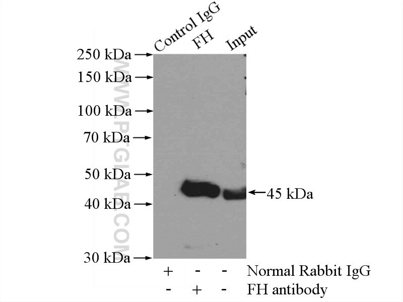 Immunoprecipitation (IP) experiment of mouse liver tissue using FH Polyclonal antibody (11375-1-AP)