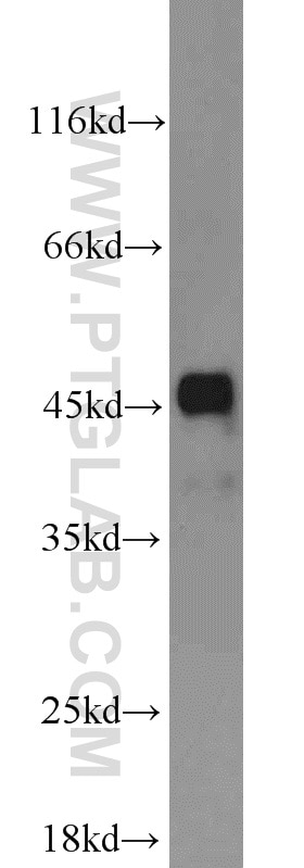 Western Blot (WB) analysis of human placenta tissue using FH Polyclonal antibody (11375-1-AP)