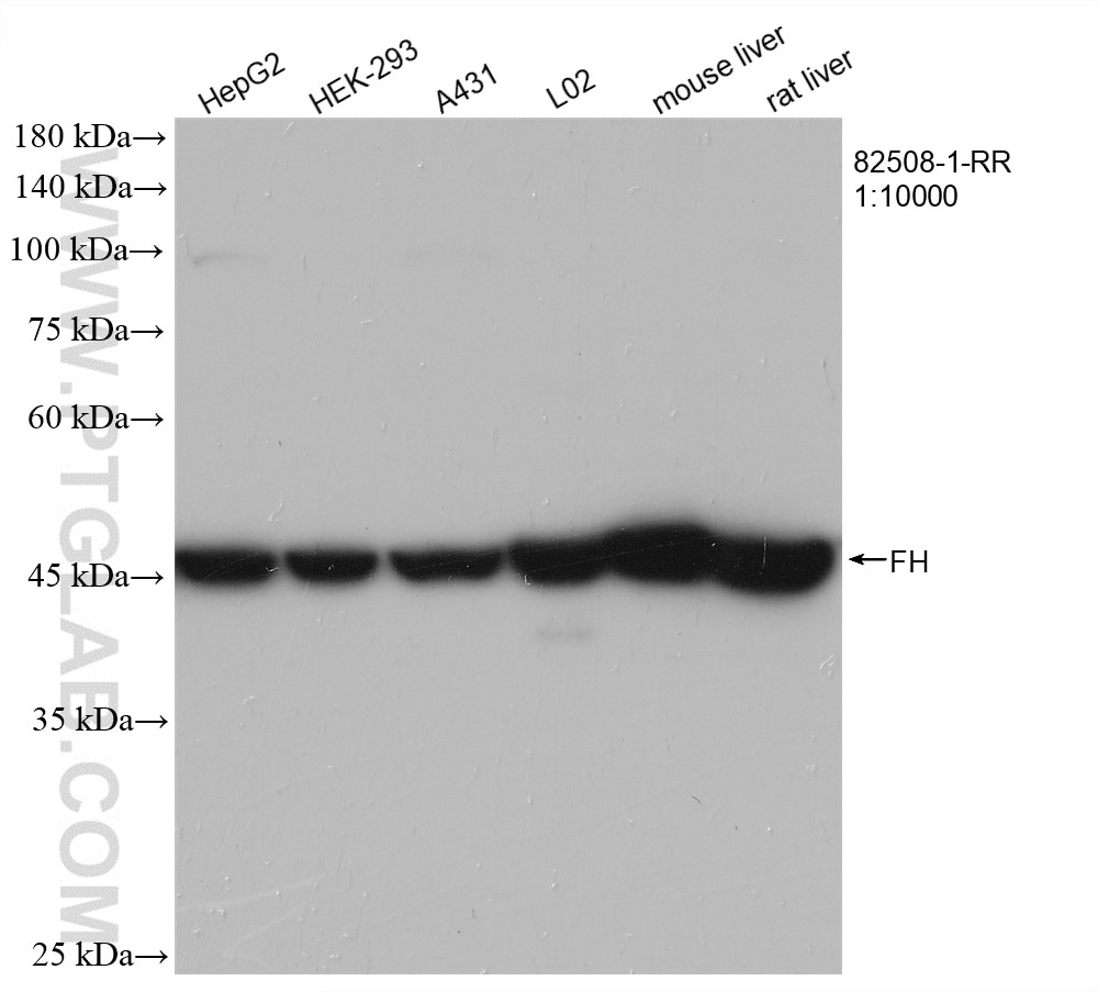 Western Blot (WB) analysis of various lysates using FH Recombinant antibody (82508-1-RR)