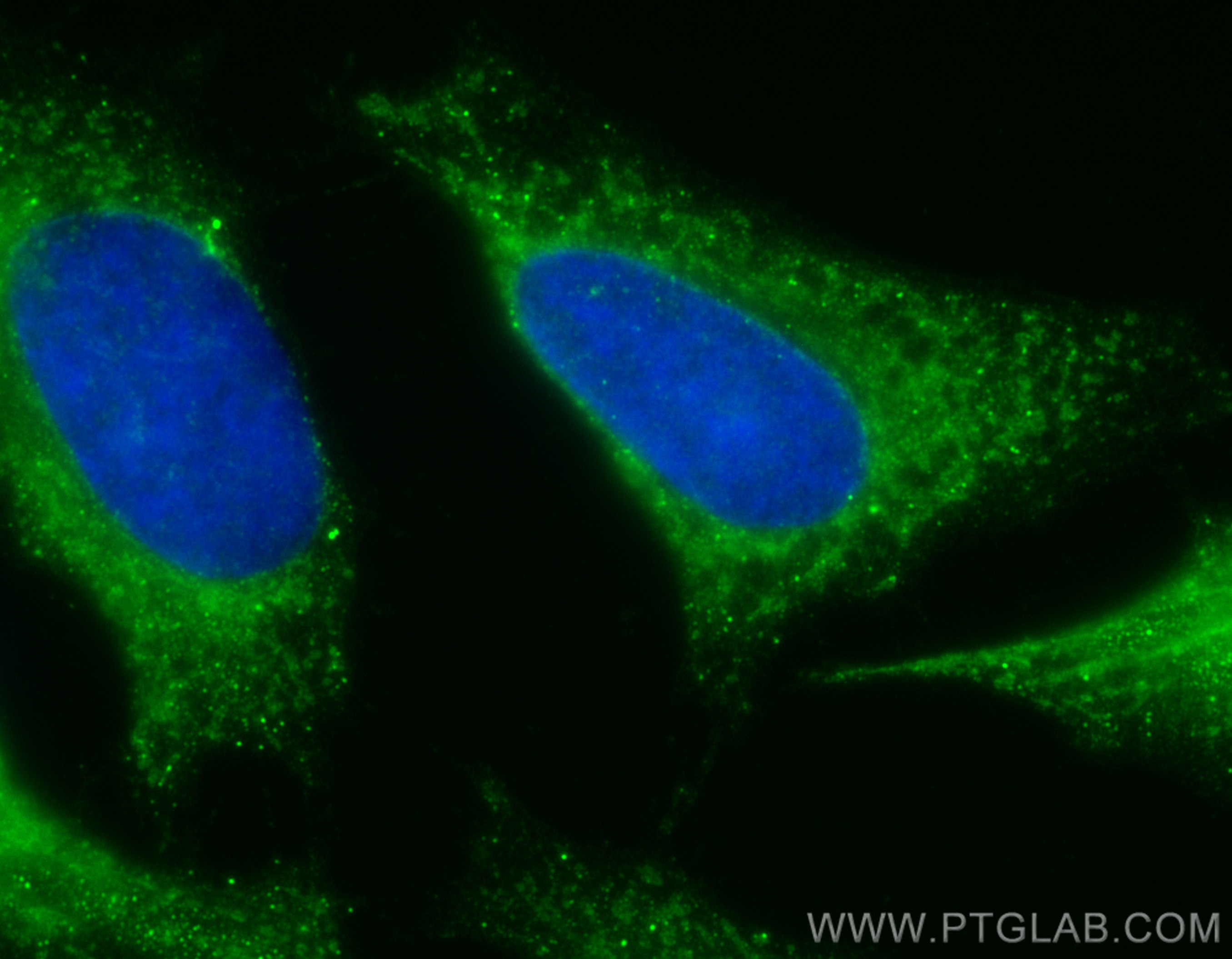 Immunofluorescence (IF) / fluorescent staining of HeLa cells using CoraLite® Plus 488-conjugated FH Polyclonal antibo (CL488-11375)