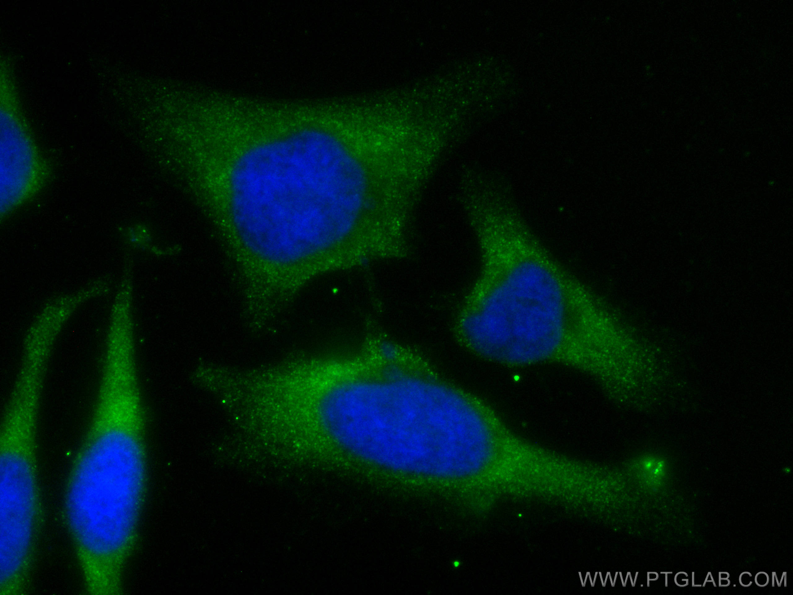 Immunofluorescence (IF) / fluorescent staining of HeLa cells using CoraLite® Plus 488-conjugated FH Monoclonal antibo (CL488-68162)