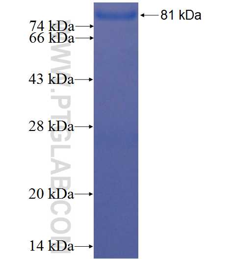 FH fusion protein Ag1437 SDS-PAGE