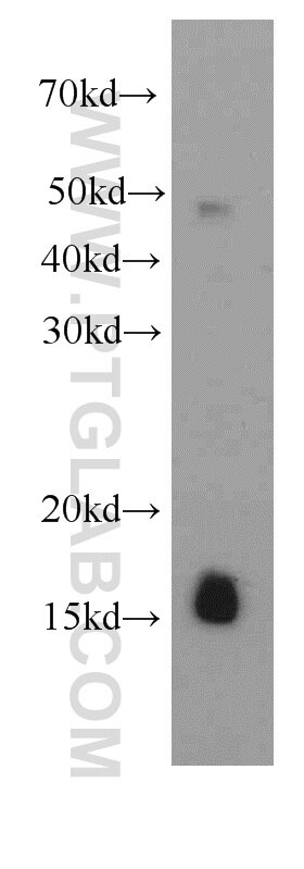 FHIT Monoclonal antibody