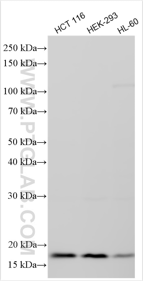 Western Blot (WB) analysis of various lysates using FHIT Recombinant antibody (83710-1-RR)