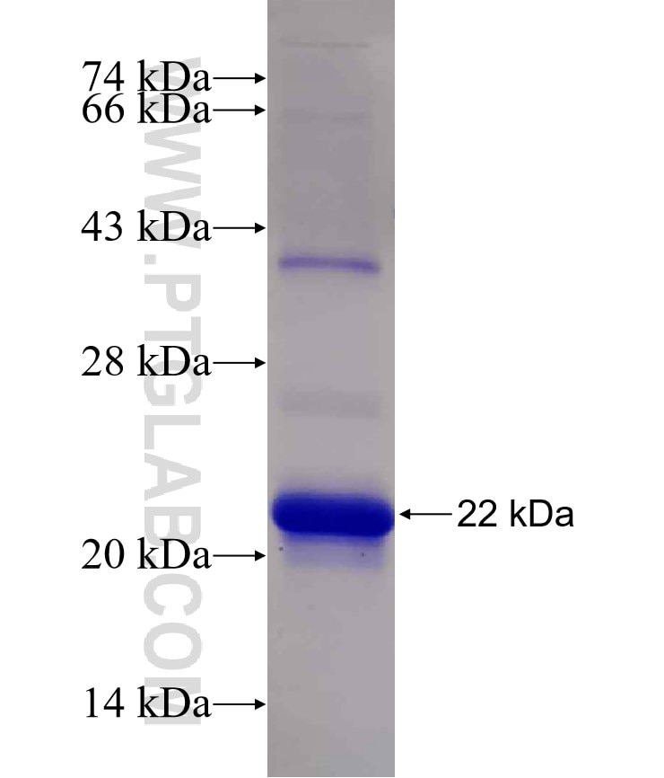 FHIT fusion protein Ag14471 SDS-PAGE