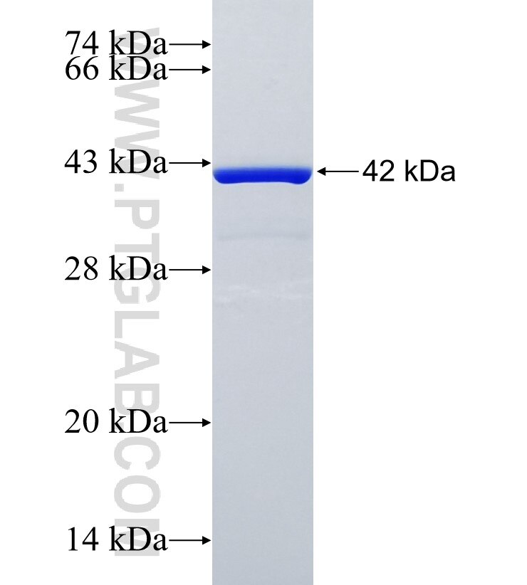 FHIT fusion protein Ag4181 SDS-PAGE