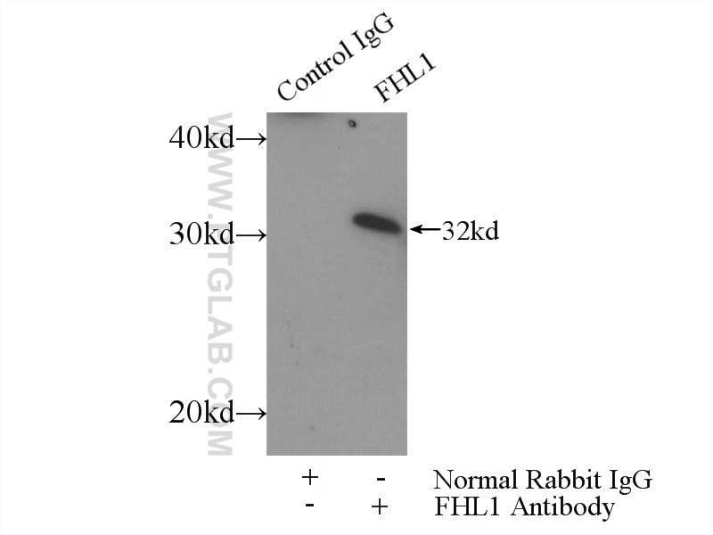 Immunoprecipitation (IP) experiment of mouse skeletal muscle tissue using FHL1 Polyclonal antibody (10991-1-AP)