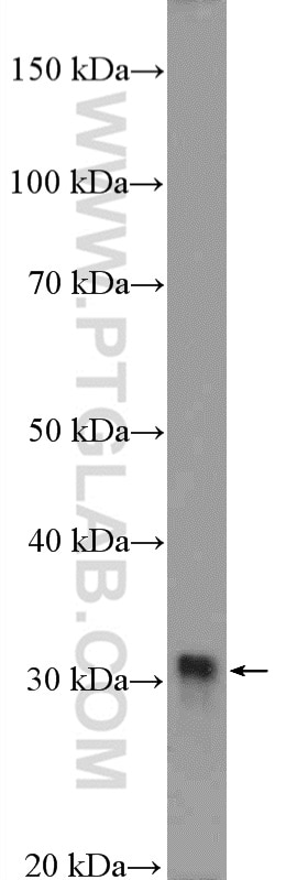 WB analysis of mouse skeletal muscle using 10991-1-AP