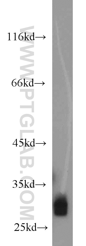 Western Blot (WB) analysis of mouse colon tissue using FHL1 Polyclonal antibody (10991-1-AP)