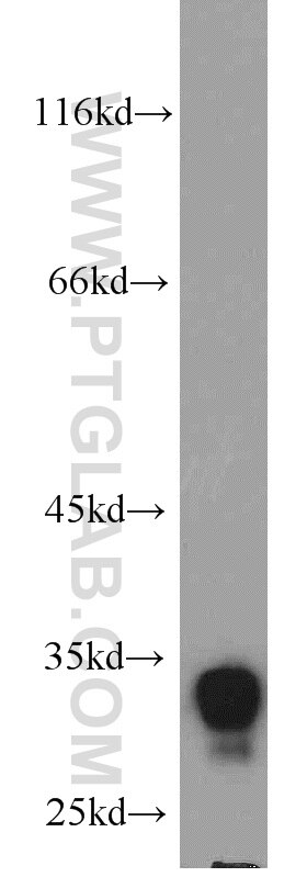 Western Blot (WB) analysis of mouse skeletal muscle tissue using FHL1 Polyclonal antibody (10991-1-AP)