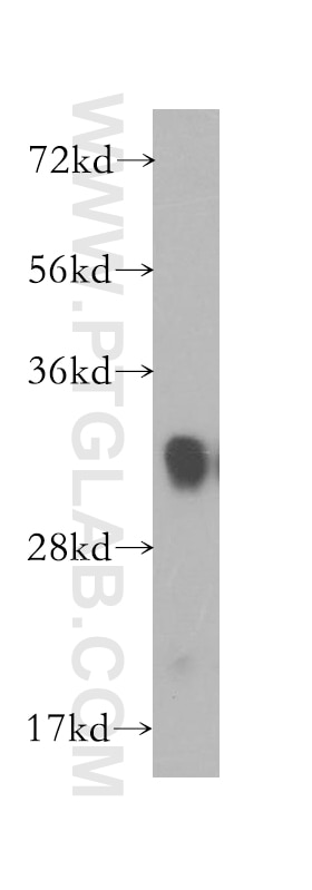 Western Blot (WB) analysis of human brain tissue using FHL1 Polyclonal antibody (10991-1-AP)