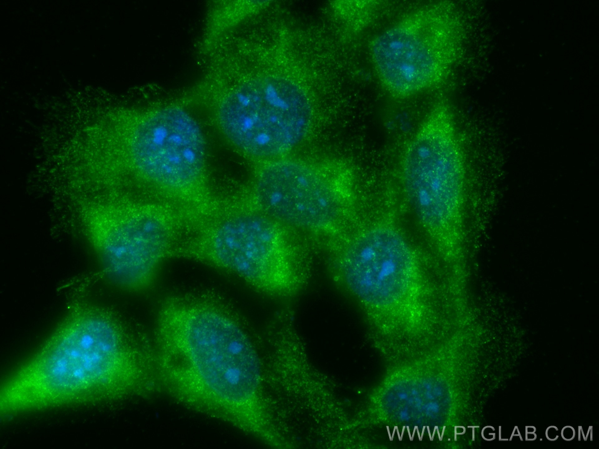 Immunofluorescence (IF) / fluorescent staining of A431 cells using FHL2 Polyclonal antibody (21619-1-AP)