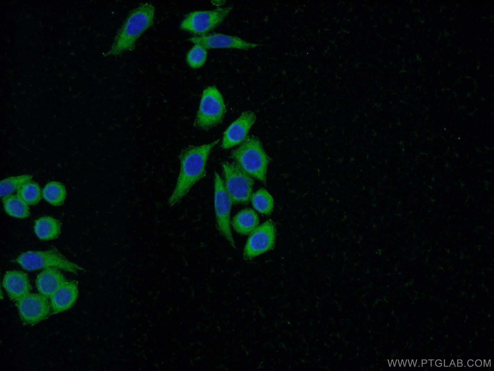 Immunofluorescence (IF) / fluorescent staining of HeLa cells using FHL2 Polyclonal antibody (21619-1-AP)