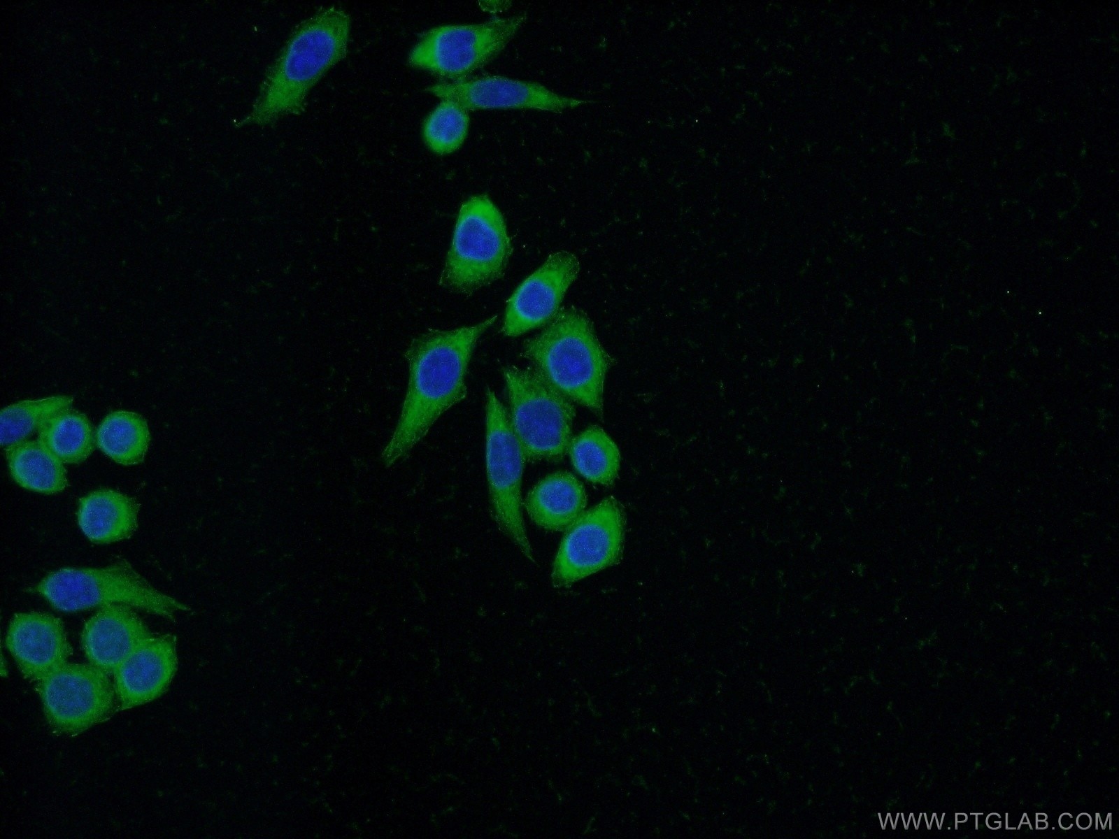 IF Staining of HeLa using 21619-1-AP