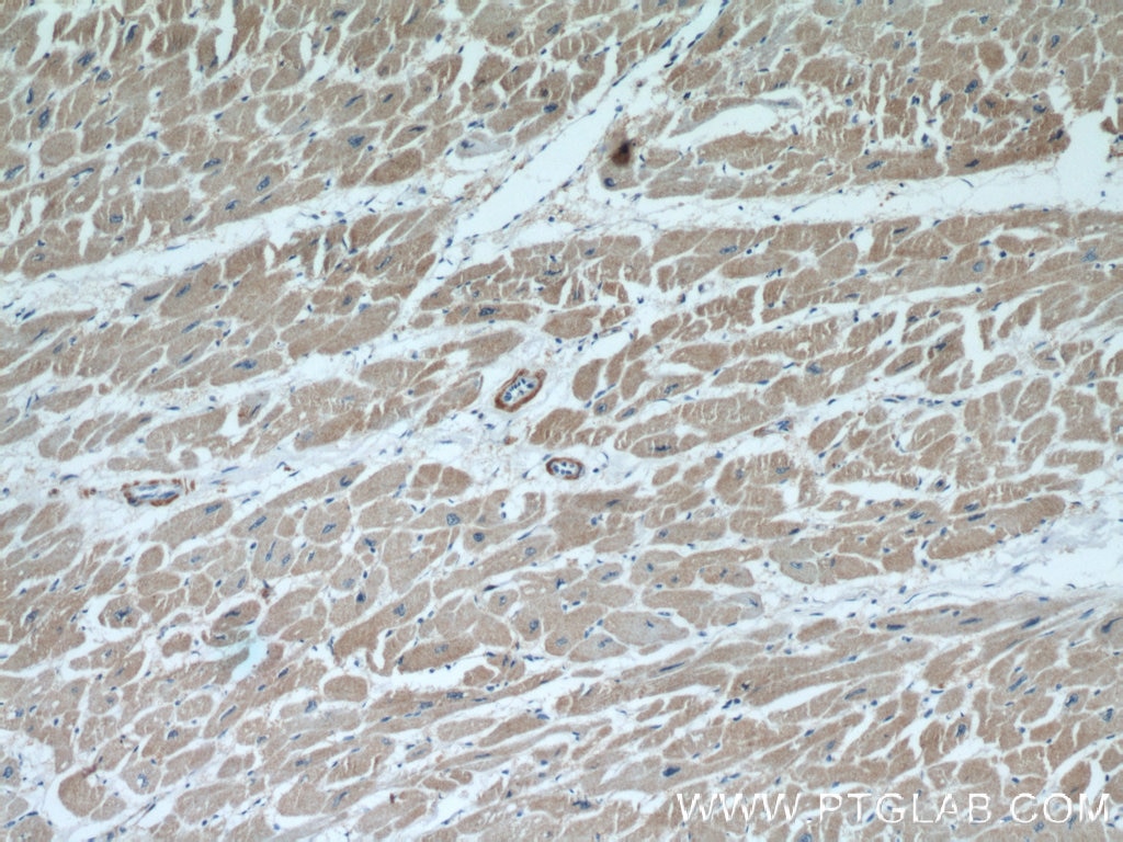 IHC staining of human heart using 21619-1-AP