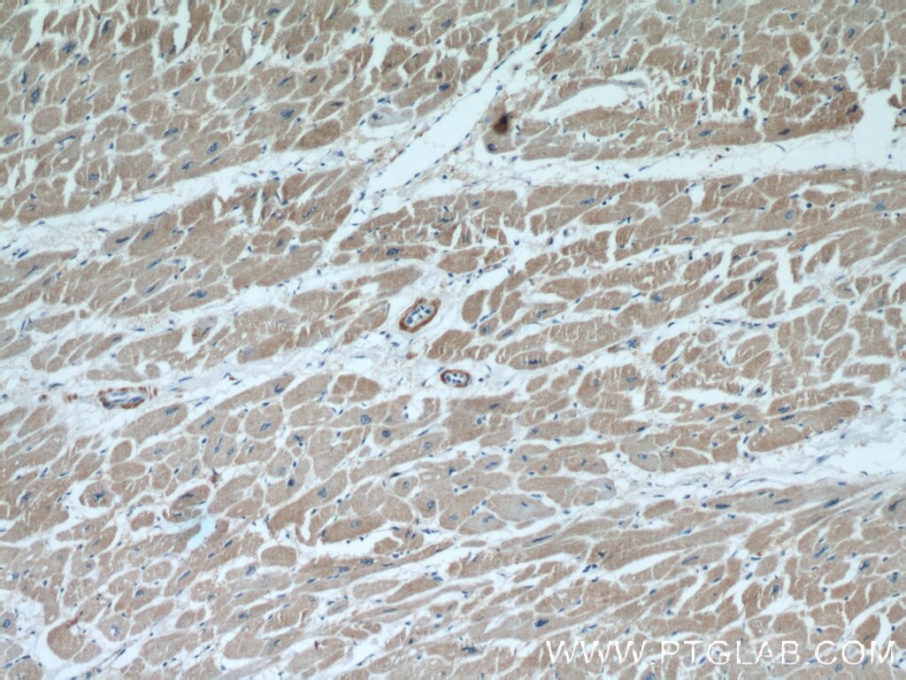 Immunohistochemistry (IHC) staining of human heart tissue using FHL2 Polyclonal antibody (21619-1-AP)