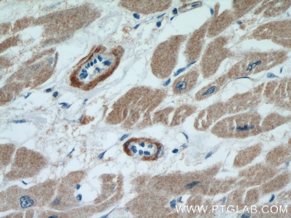 IHC staining of human heart using 21619-1-AP