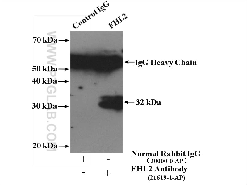 Immunoprecipitation (IP) experiment of mouse skeletal muscle tissue using FHL2 Polyclonal antibody (21619-1-AP)