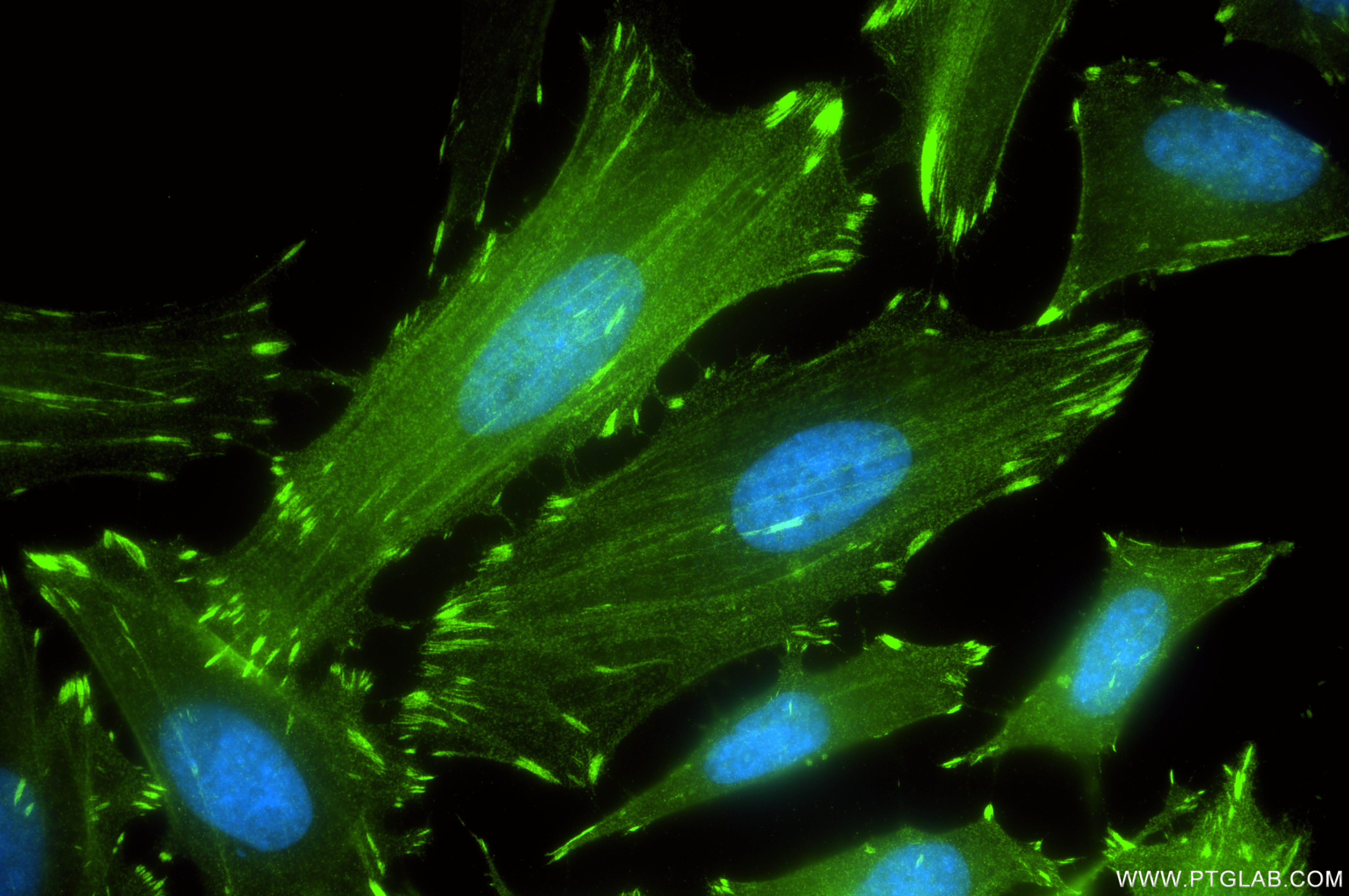 Immunofluorescence (IF) / fluorescent staining of HeLa cells using FHL2 Recombinant antibody (86060-1-RR)
