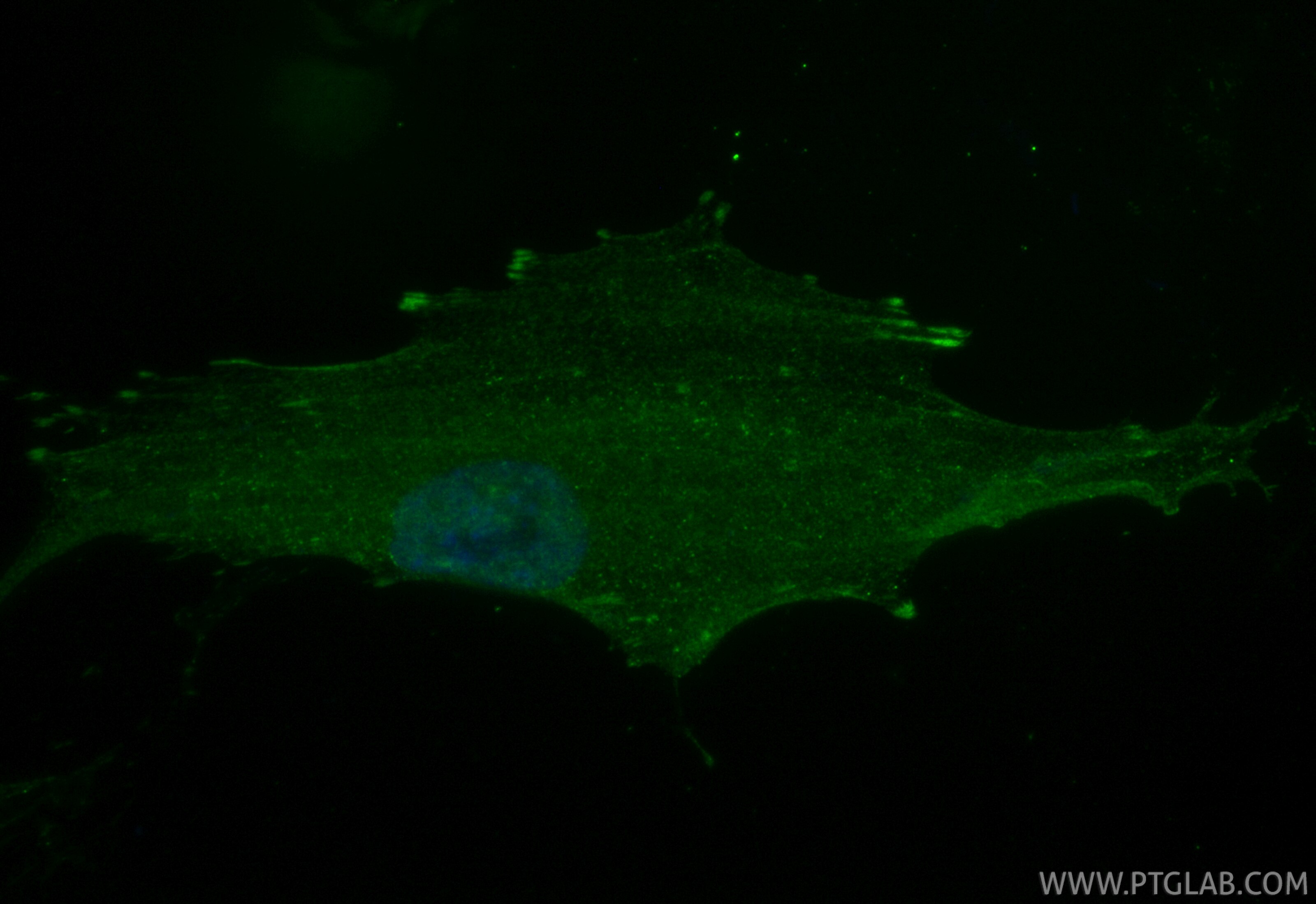 Immunofluorescence (IF) / fluorescent staining of HSkMC cells using CoraLite® Plus 488-conjugated FHL2 Recombinant mon (CL488-86060)