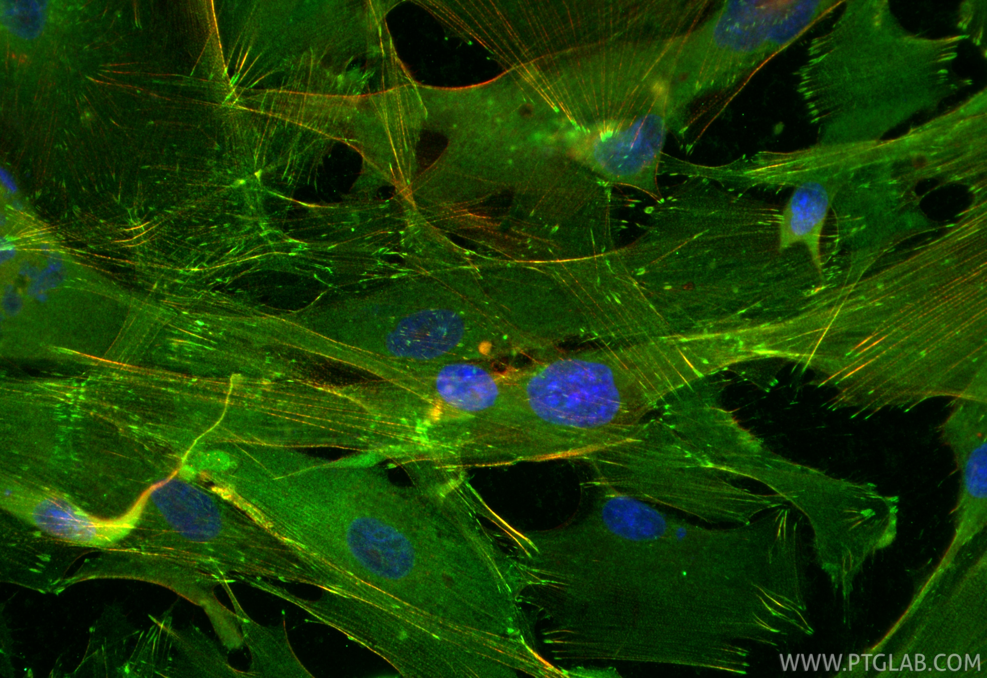 Immunofluorescence (IF) / fluorescent staining of HSkMC cells using Multi-rAb® FHL2 Multi-Recombinant antibody (RMX00084)