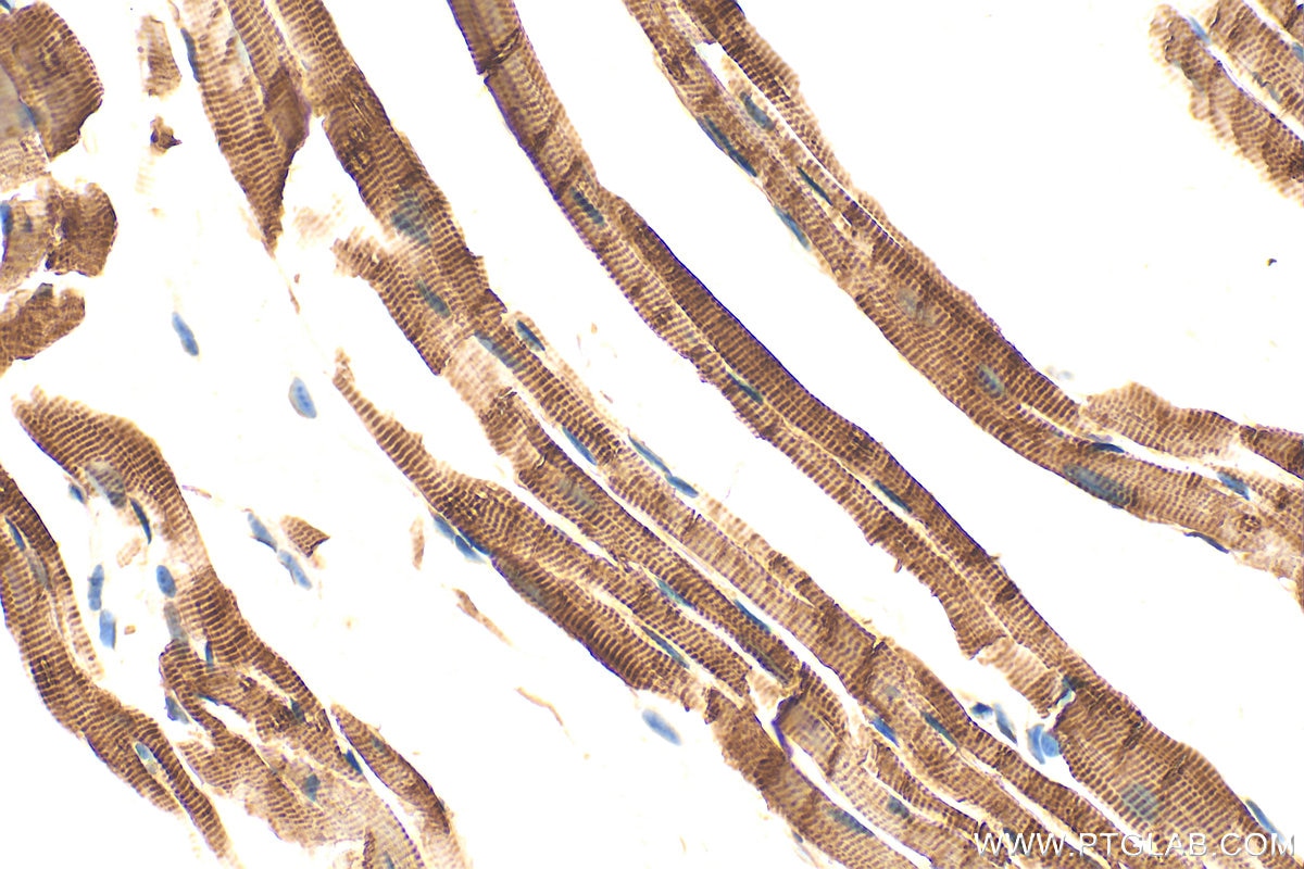 Immunohistochemistry (IHC) staining of mouse heart tissue using Multi-rAb® FHL2 Multi-Recombinant antibody (RMX00084)