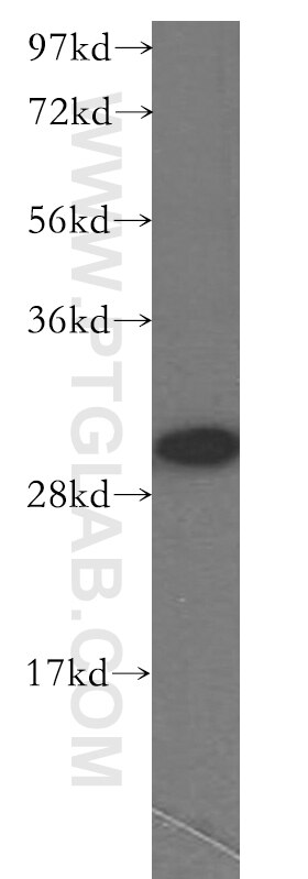 Western Blot (WB) analysis of mouse ovary tissue using FHL3 Polyclonal antibody (11028-2-AP)