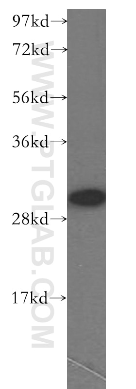 Western Blot (WB) analysis of mouse ovary tissue using FHL3 Polyclonal antibody (11028-2-AP)