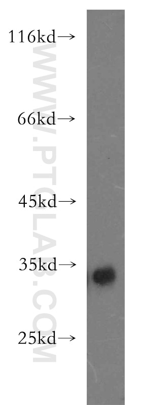 Western Blot (WB) analysis of K-562 cells using FHL3 Polyclonal antibody (11028-2-AP)