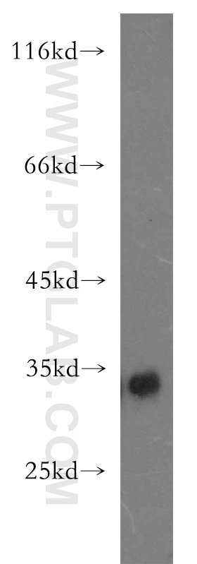 WB analysis of K-562 using 11028-2-AP