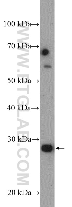 WB analysis of mouse heart using 12650-2-AP