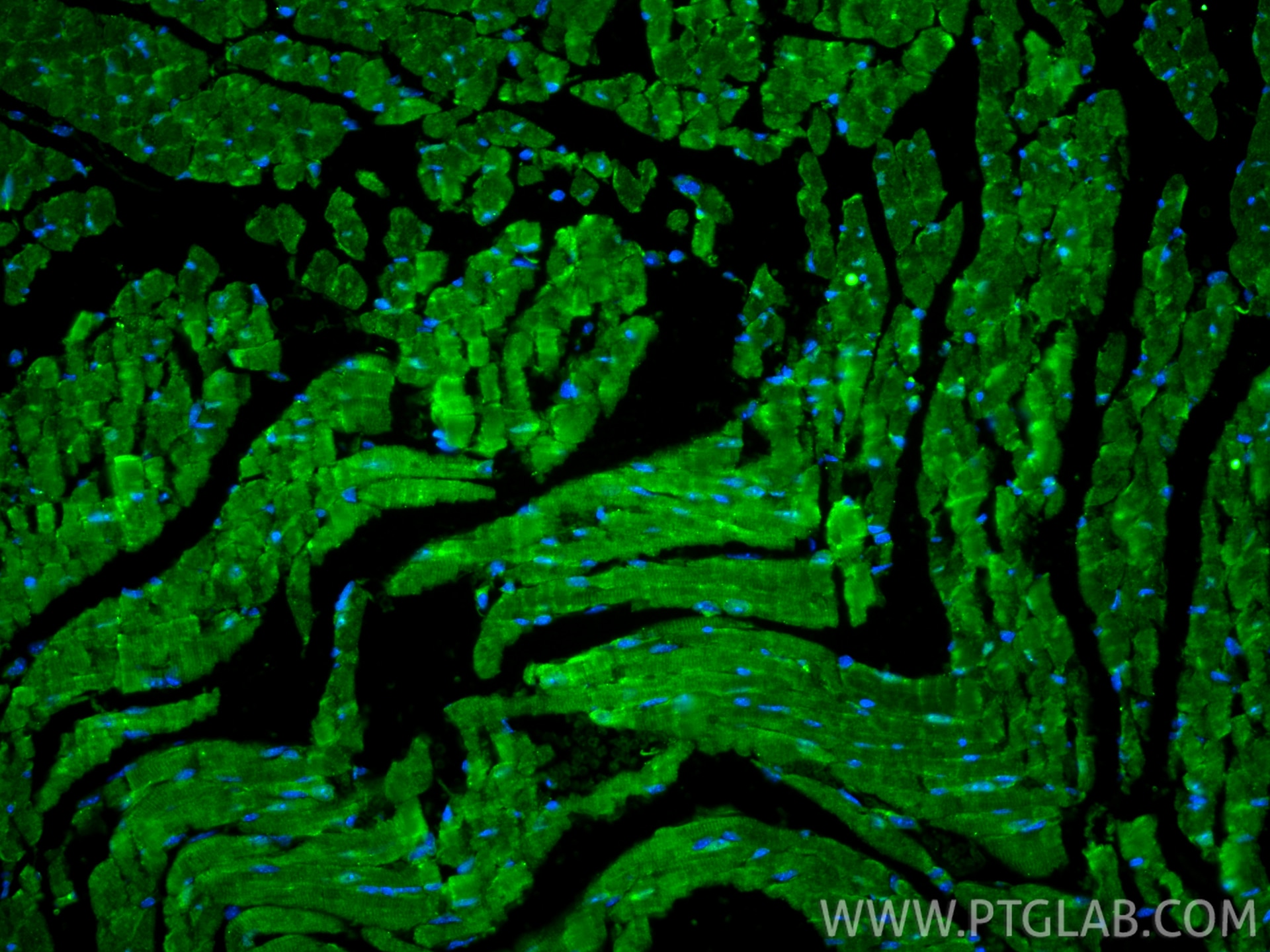 Immunofluorescent analysis of (4% PFA) fixed paraffin-embedded mouse heart tissue using FHOD3 antibody (31744-1-AP) at dilution of 1:200 and CoraLite®488-Conjugated Goat Anti-Rabbit IgG(H+L) (SA00013-2). Heat mediated antigen retrieval with Tris-EDTA buffer (pH 9.0). Immunofluorescence (IF) / fluorescent staining of mouse heart tissue using FHOD3 Polyclonal antibody (31744-1-AP)