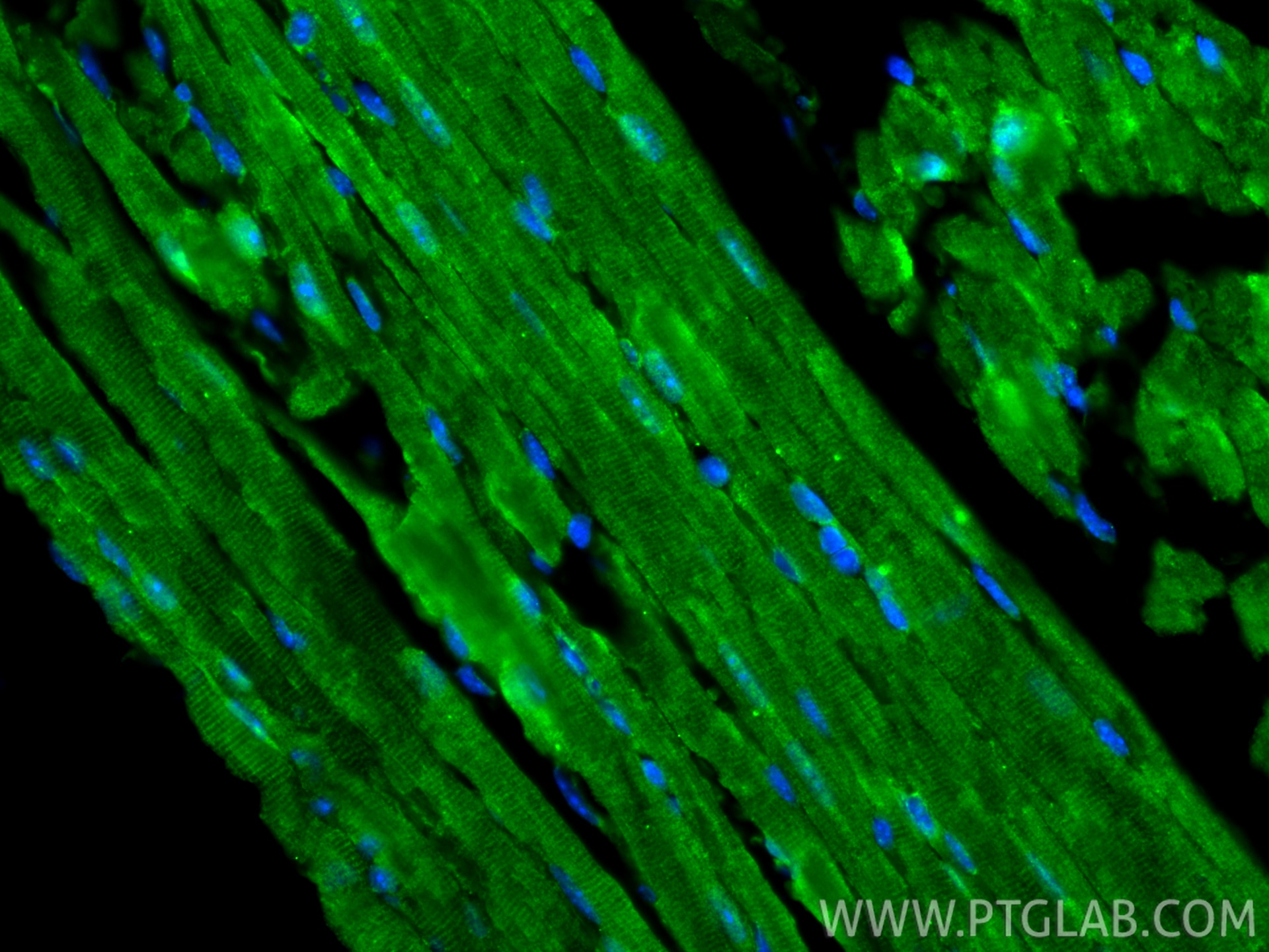 Immunofluorescent analysis of (4% PFA) fixed paraffin-embedded mouse heart tissue using FHOD3 antibody (31744-1-AP) at dilution of 1:200 and CoraLite®488-Conjugated Goat Anti-Rabbit IgG(H+L) (SA00013-2). Heat mediated antigen retrieval with Tris-EDTA buffer (pH 9.0). Immunofluorescence (IF) / fluorescent staining of mouse heart tissue using FHOD3 Polyclonal antibody (31744-1-AP)