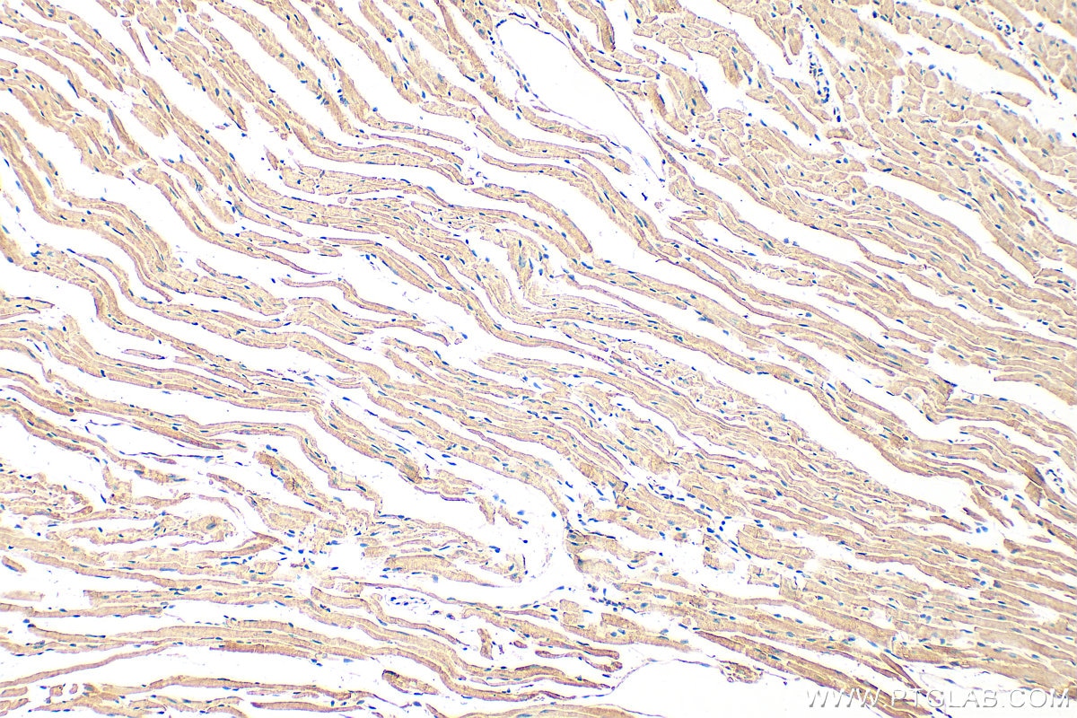 Immunohistochemical analysis of paraffin-embedded mouse heart tissue slide using 31744-1-AP (FHOD3 antibody) at dilution of 1:200 (under 10x lens). Heat mediated antigen retrieval with Tris-EDTA buffer (pH 9.0). Immunohistochemistry (IHC) staining of mouse heart tissue using FHOD3 Polyclonal antibody (31744-1-AP)