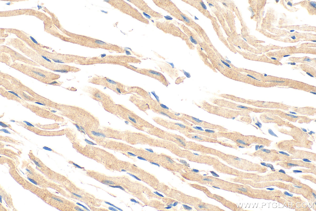 Immunohistochemical analysis of paraffin-embedded mouse heart tissue slide using 31744-1-AP (FHOD3 antibody) at dilution of 1:200 (under 40x lens). Heat mediated antigen retrieval with Tris-EDTA buffer (pH 9.0). Immunohistochemistry (IHC) staining of mouse heart tissue using FHOD3 Polyclonal antibody (31744-1-AP)