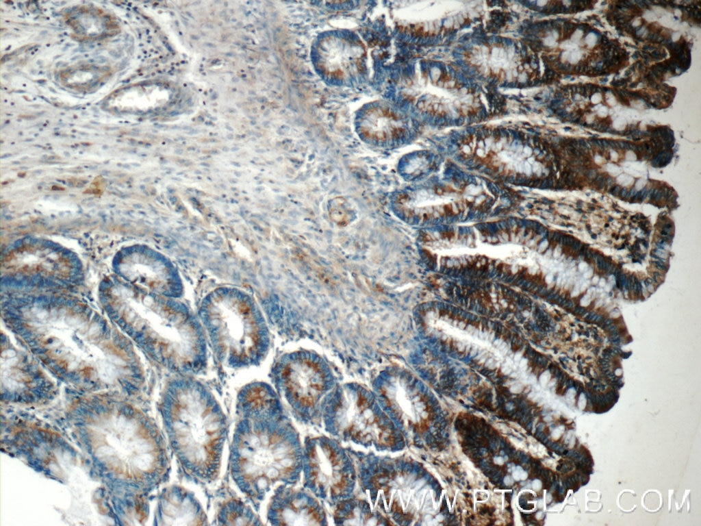 Immunohistochemistry (IHC) staining of human colon tissue using FIBCD1 Polyclonal antibody (25125-1-AP)