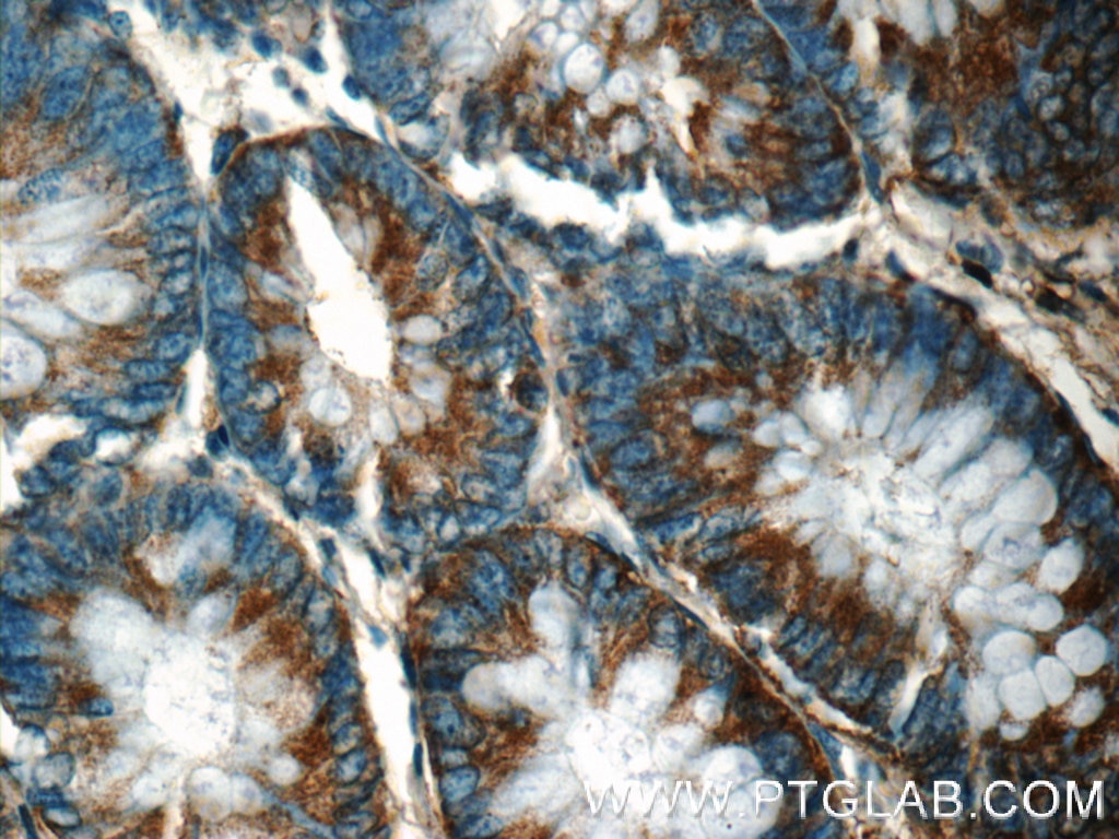 Immunohistochemistry (IHC) staining of human colon tissue using FIBCD1 Polyclonal antibody (25125-1-AP)