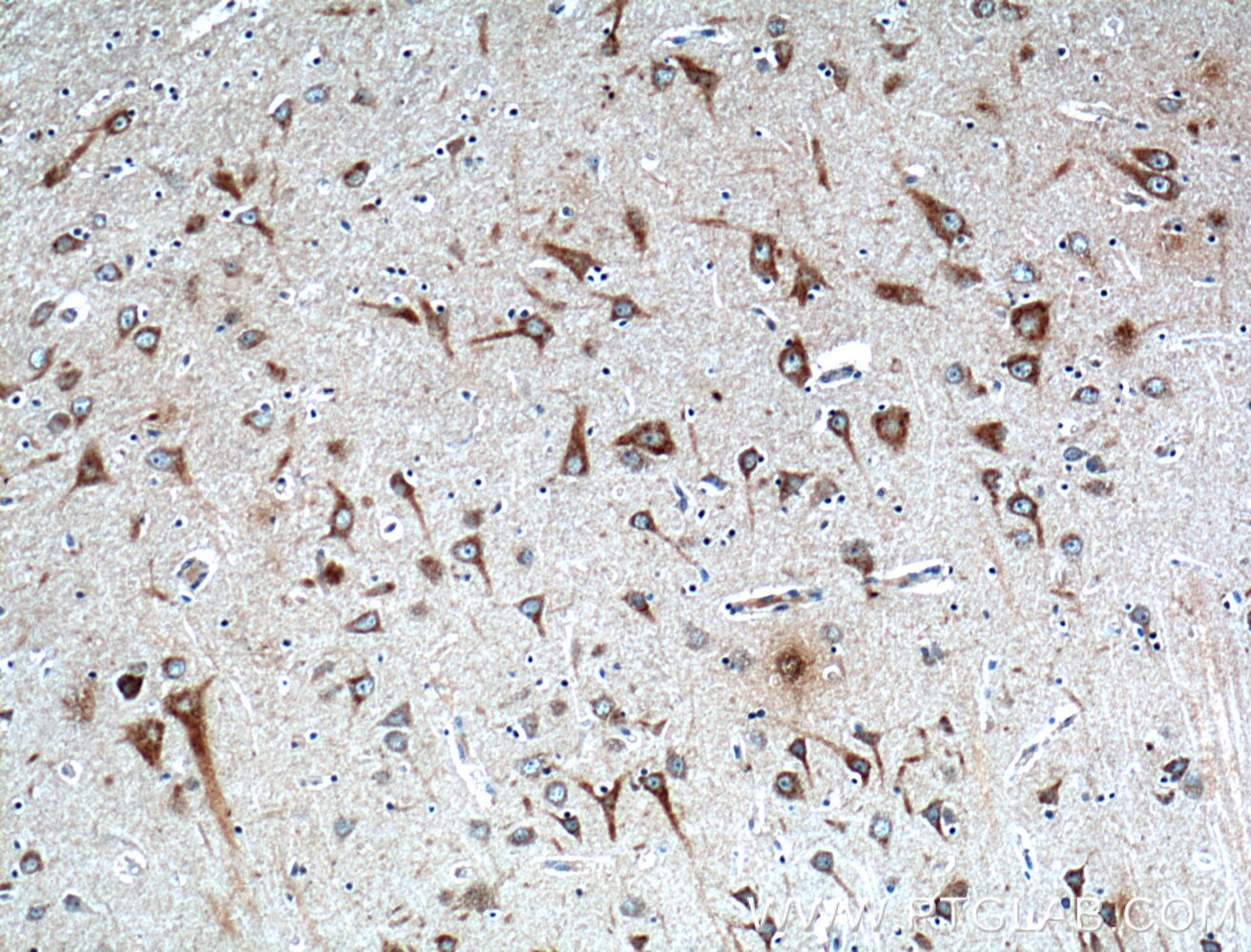 Immunohistochemistry (IHC) staining of human brain tissue using FIBIN Polyclonal antibody (27051-1-AP)