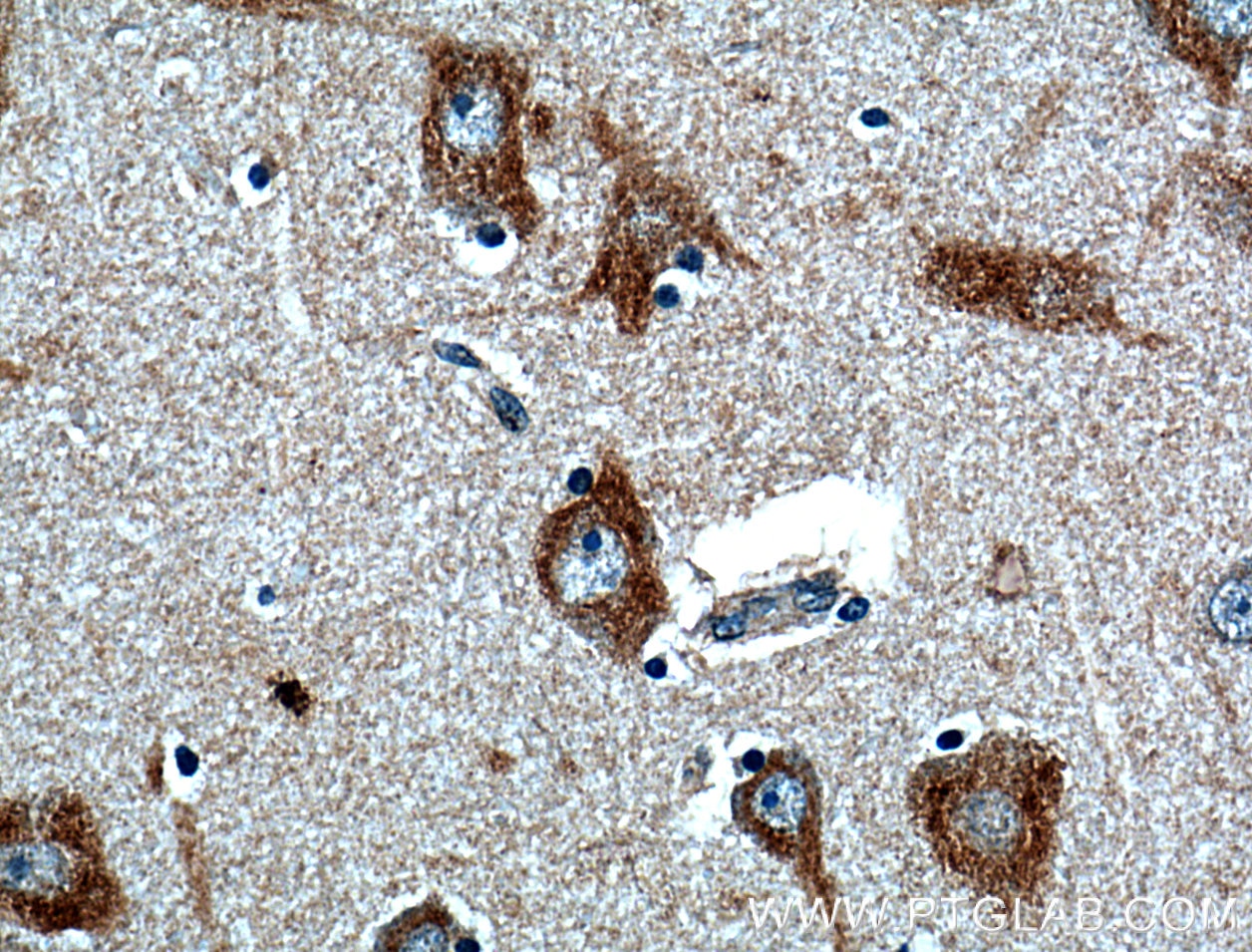 Immunohistochemistry (IHC) staining of human brain tissue using FIBIN Polyclonal antibody (27051-1-AP)