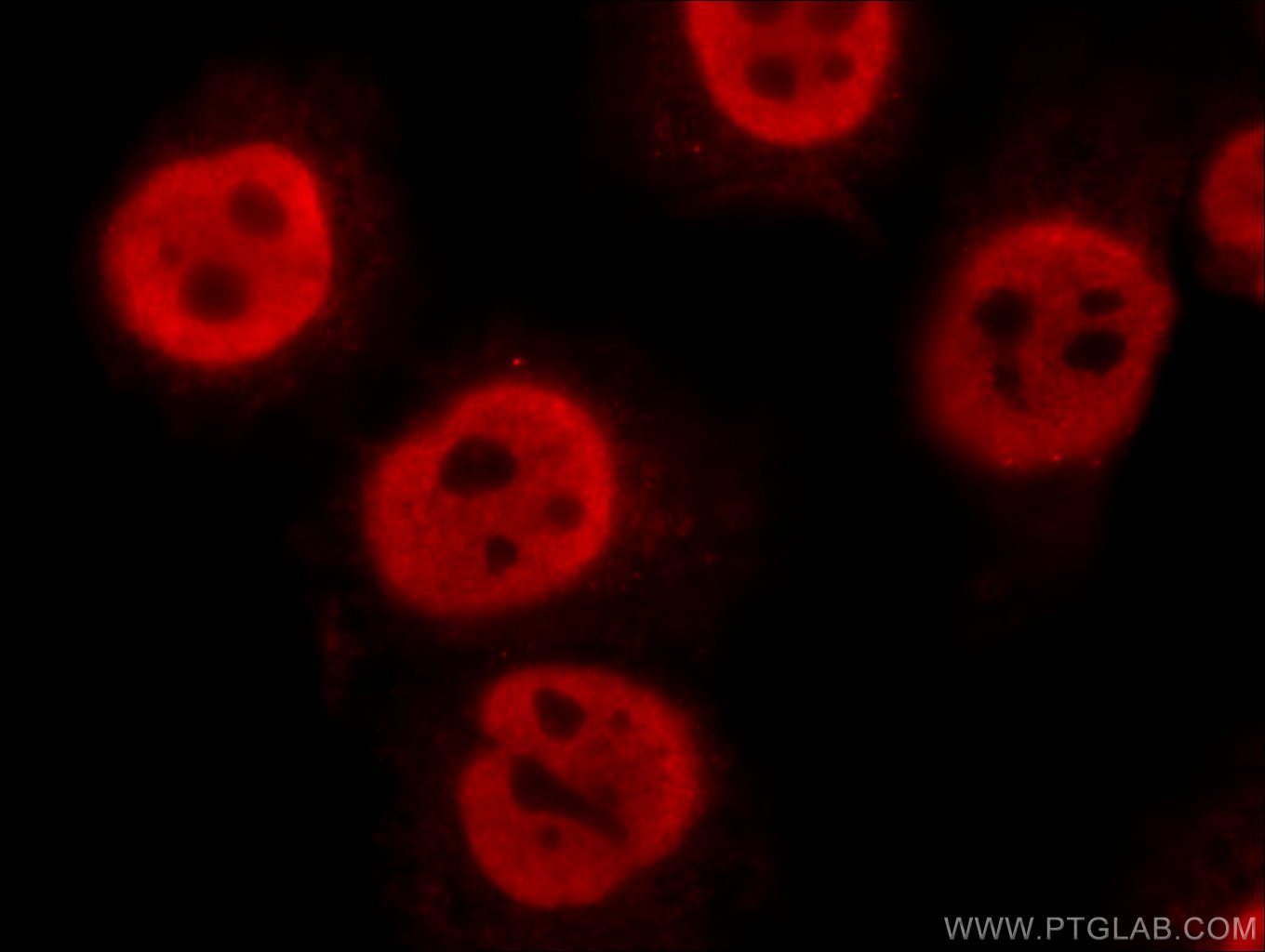 Immunofluorescence (IF) / fluorescent staining of HepG2 cells using FIBP Polyclonal antibody (15968-1-AP)