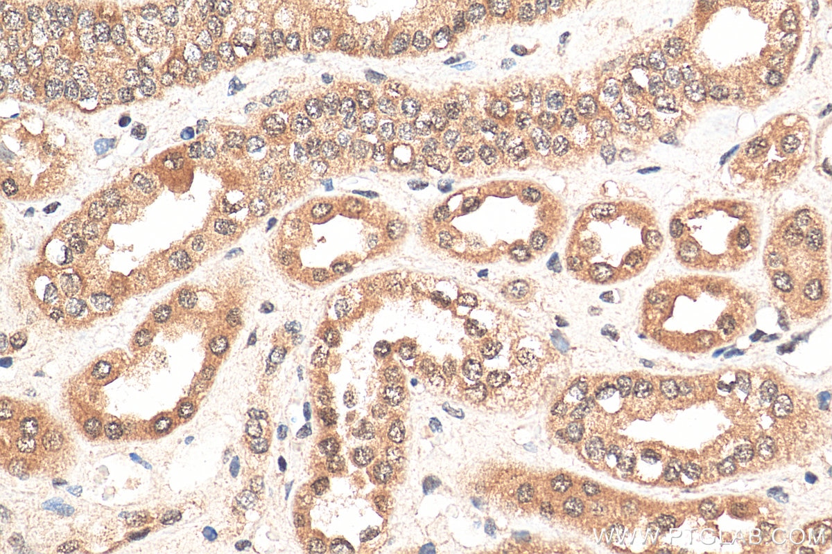 Immunohistochemistry (IHC) staining of human kidney tissue using FIBP Polyclonal antibody (15968-1-AP)