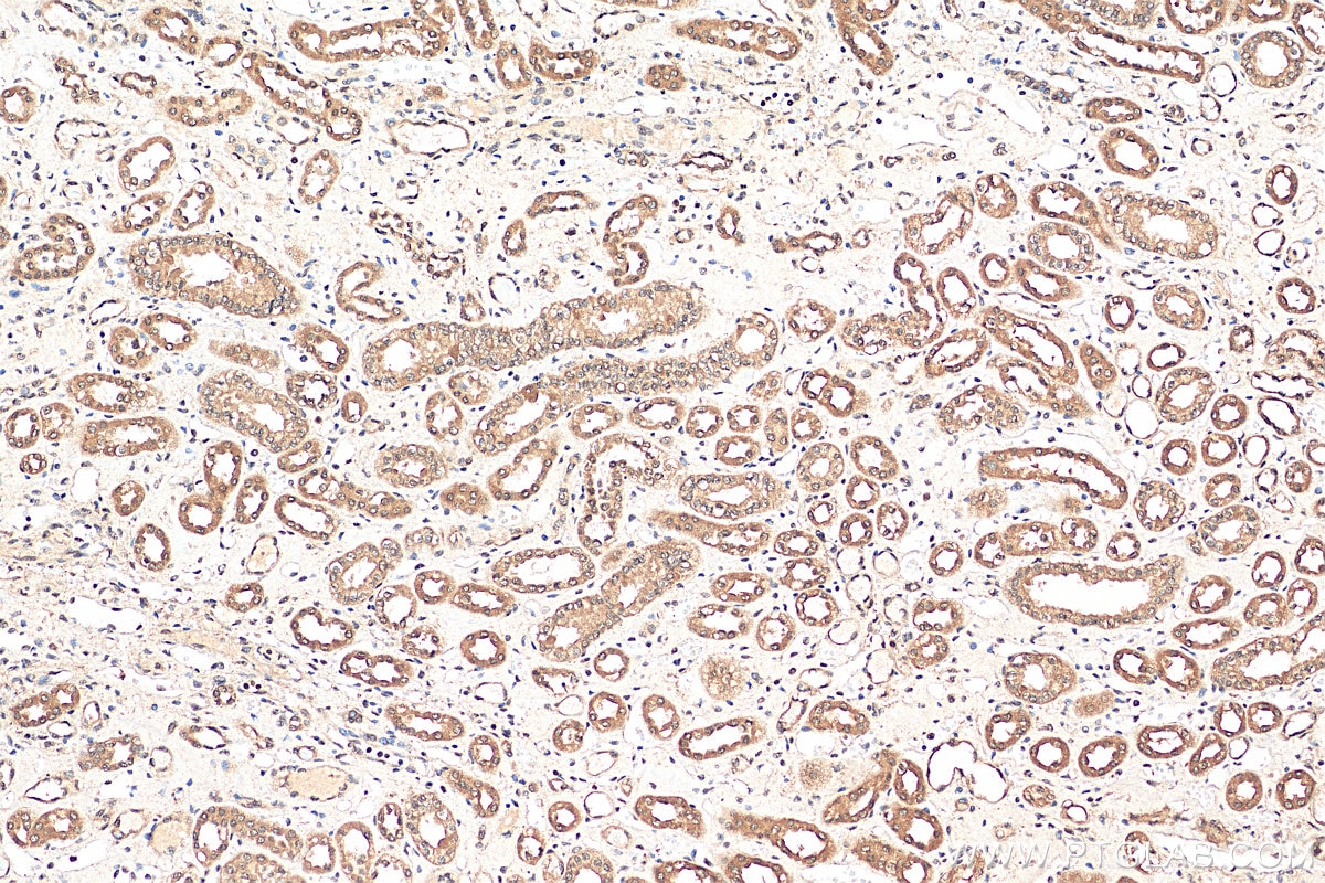 Immunohistochemistry (IHC) staining of human kidney tissue using FIBP Polyclonal antibody (15968-1-AP)
