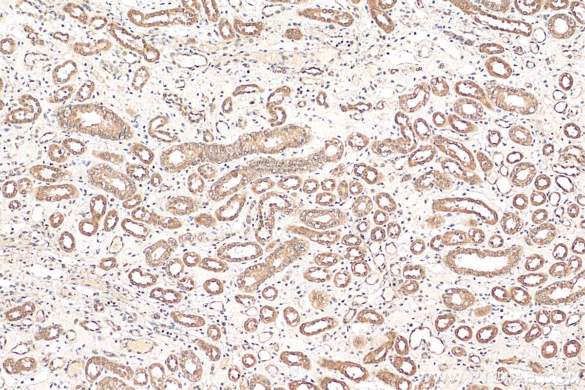 IHC staining of human kidney using 15968-1-AP