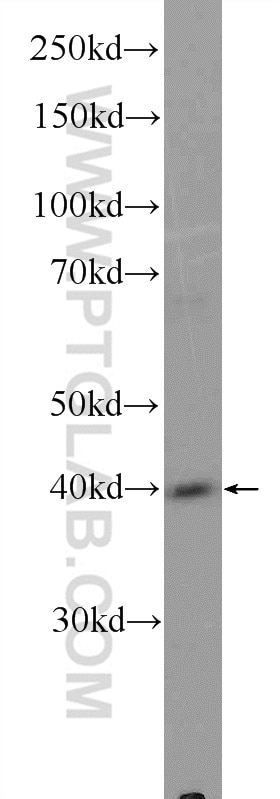 Western Blot (WB) analysis of mouse pancreas tissue using FIBP Polyclonal antibody (15968-1-AP)